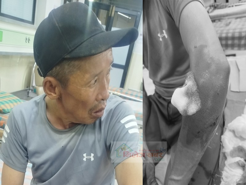 भालुको आक्रमणबाट जिरीका दुईजना घाईते, उपचारका लागि काठमाण्डौं पठाईयो